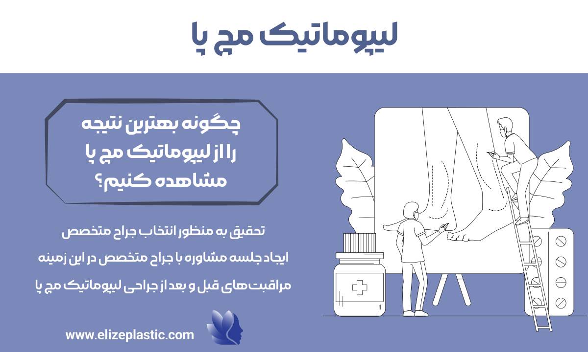 لیپوماتیک مچ پا
