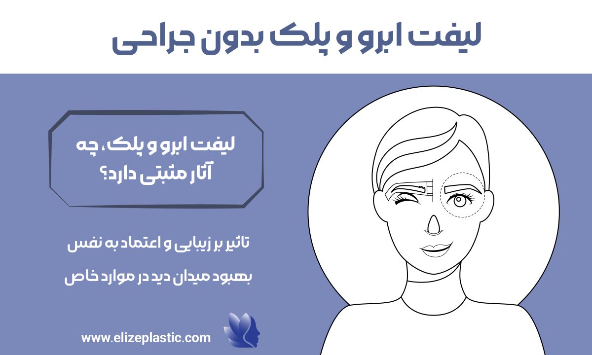 لیفت ابرو و پلک بدون جراحی‌ 