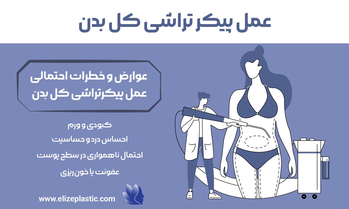 عمل پیکر تراشی کل بدن