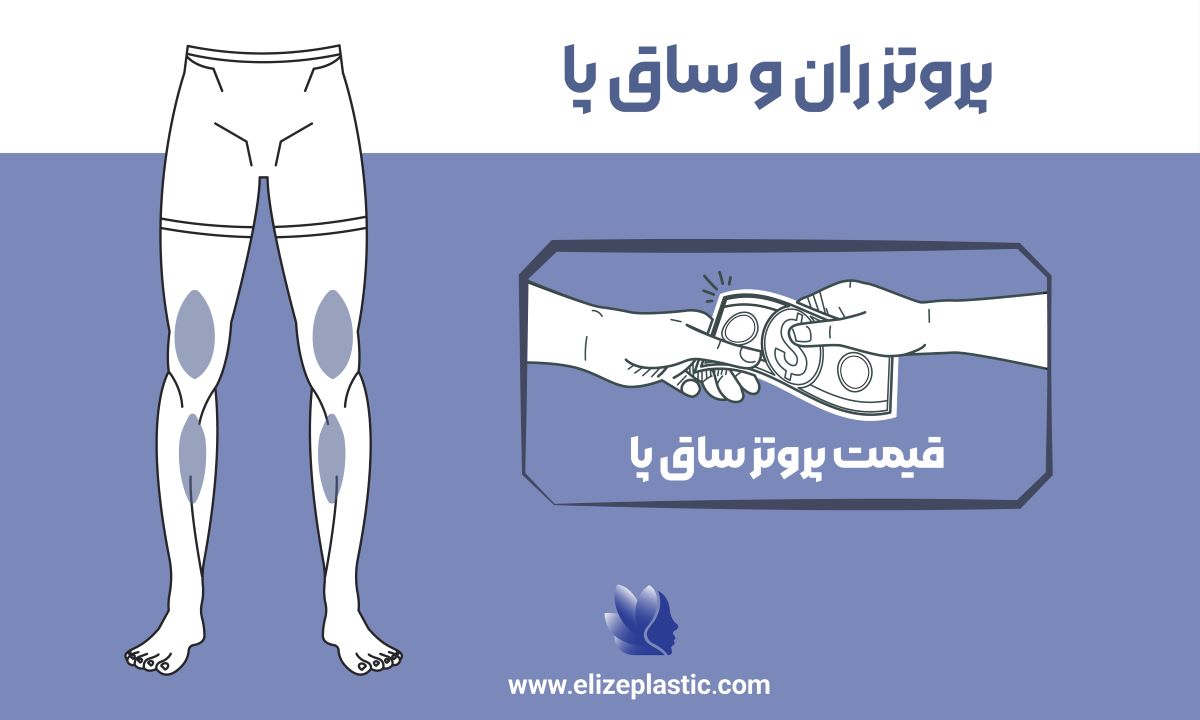 پروتز ران و ساق پا