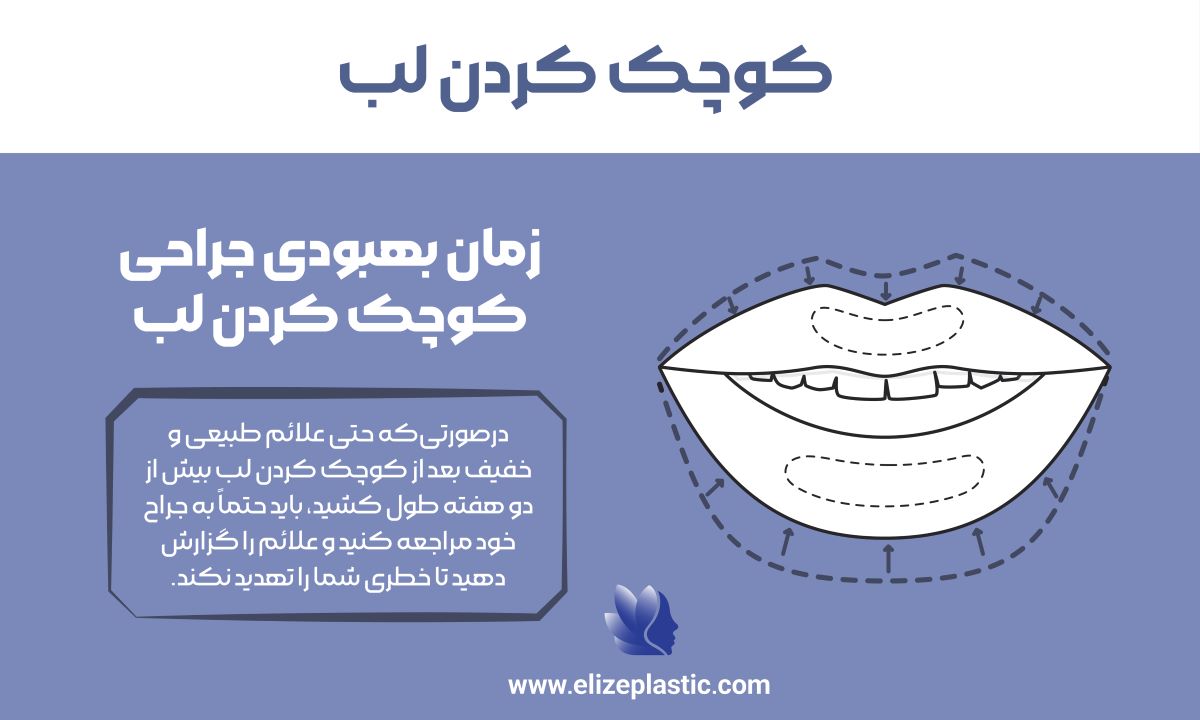 کوچک کردن لب 