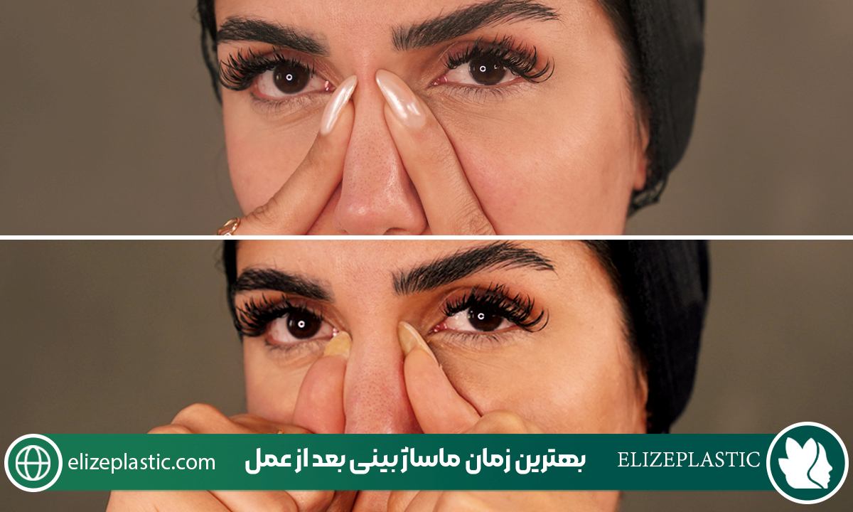 ماساژ بینی بعد از عمل 