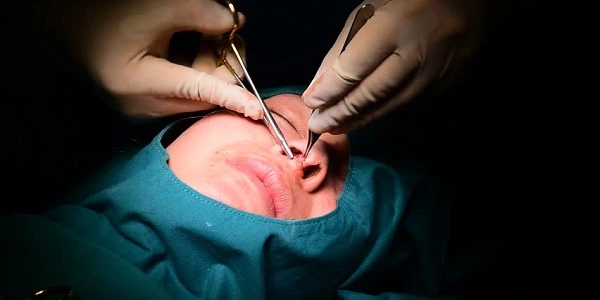 Nose-surgeon