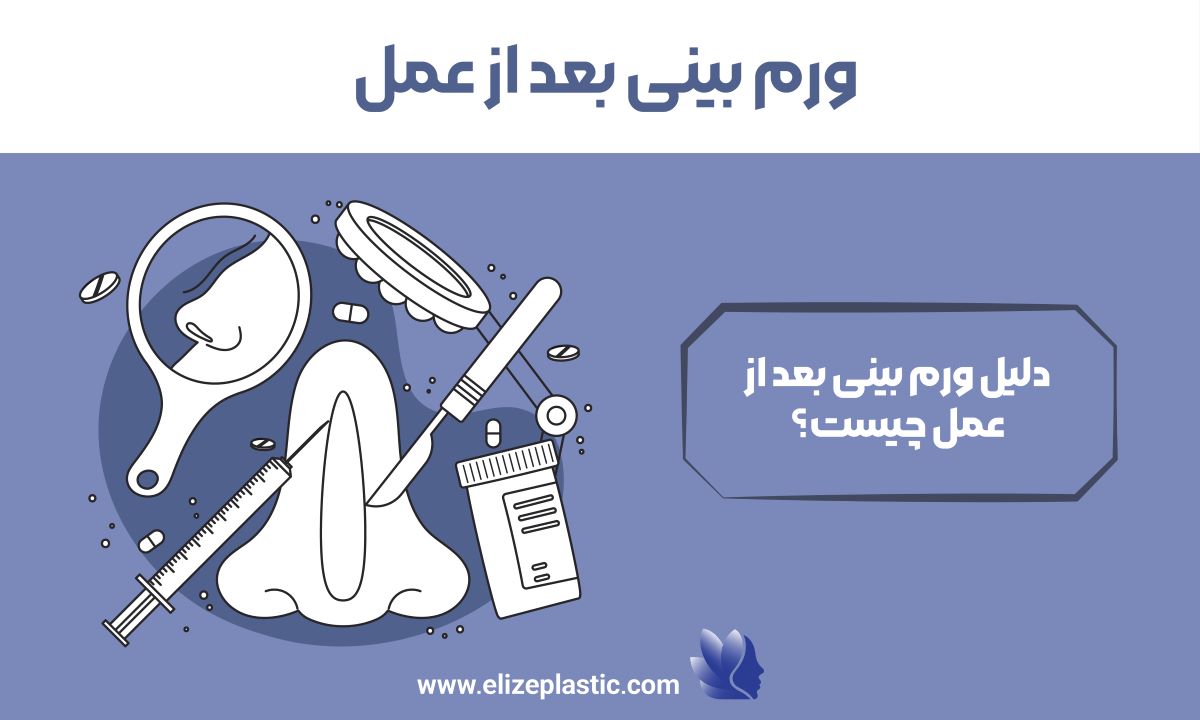 ورم بینی بعد از عمل