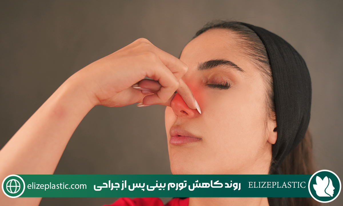 ورم بینی بعد از عمل