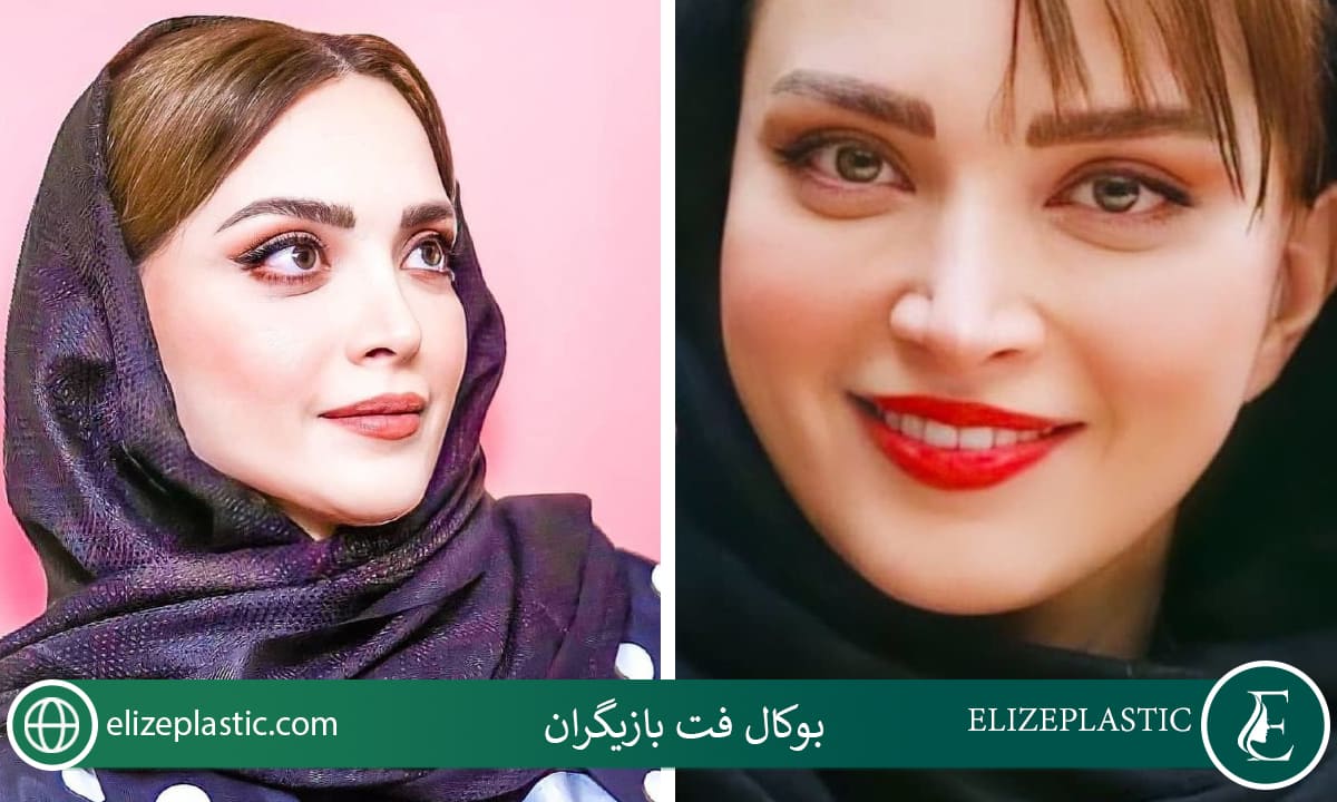 بوکال فت بازیگران