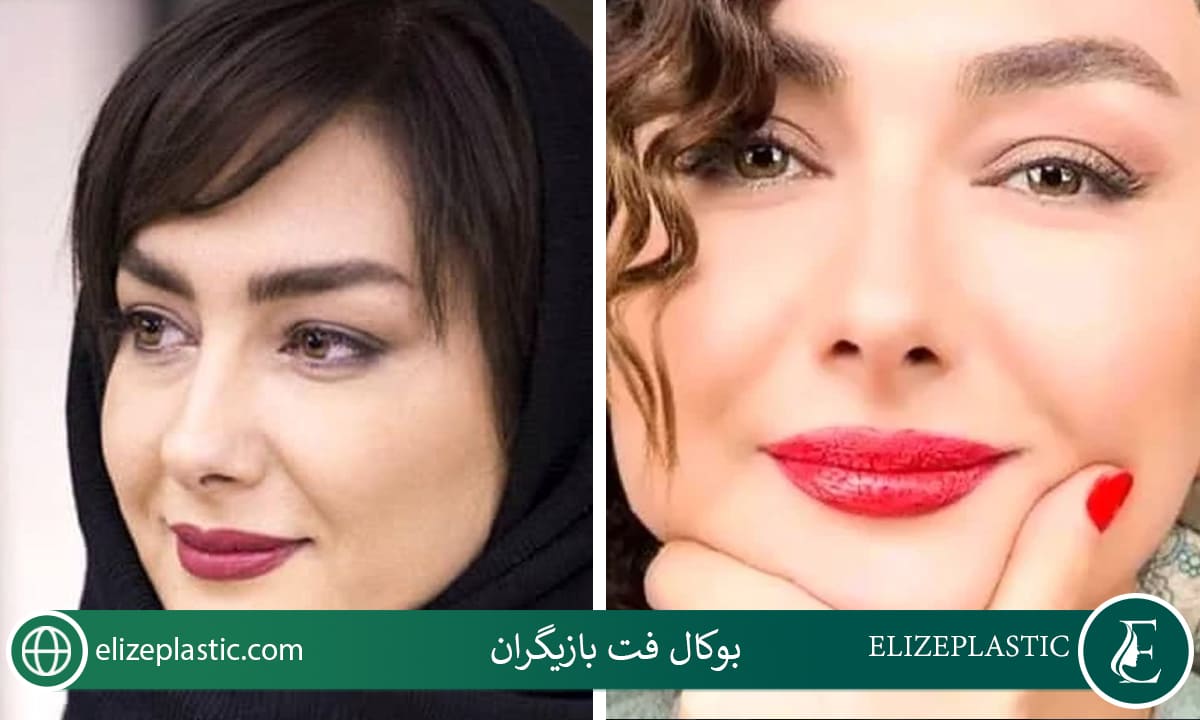 بوکال فت بازیگران