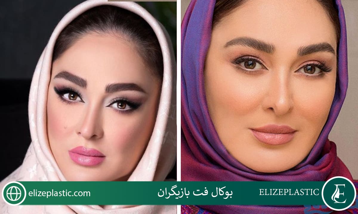 بوکال فت بازیگران