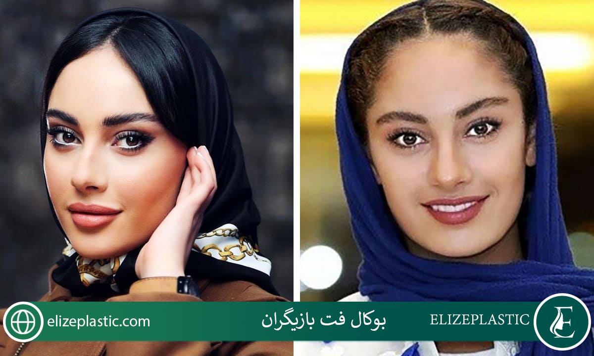 بوکال فت بازیگران