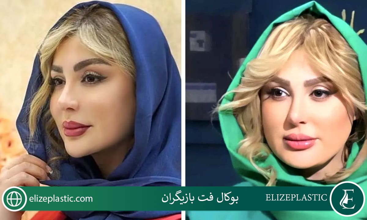 بوکال فت بازیگران