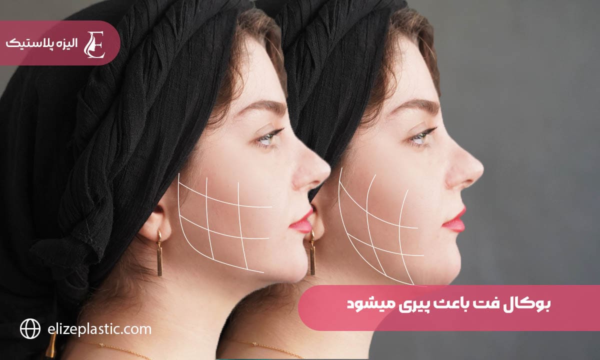 بوکال فت باعث پیری میشود