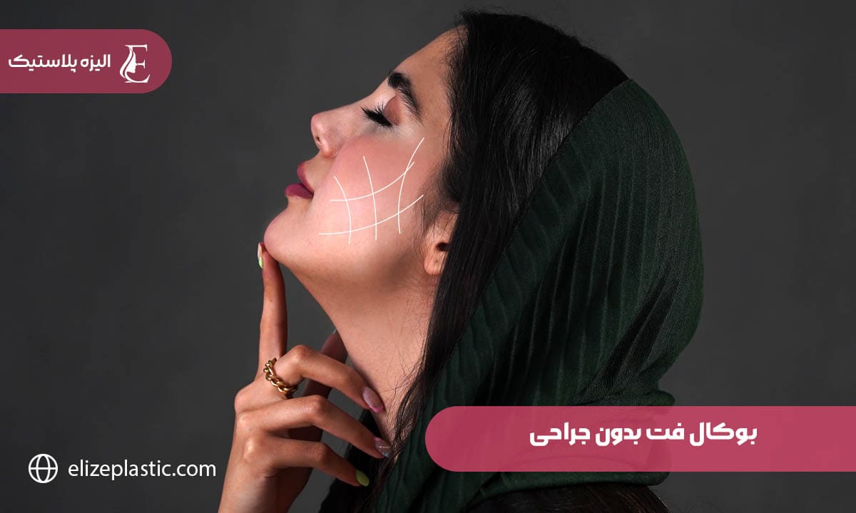 بوکال فت بدون جراحی