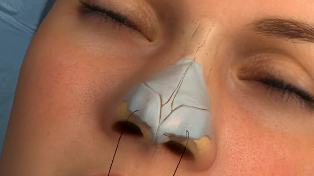 doll-nose