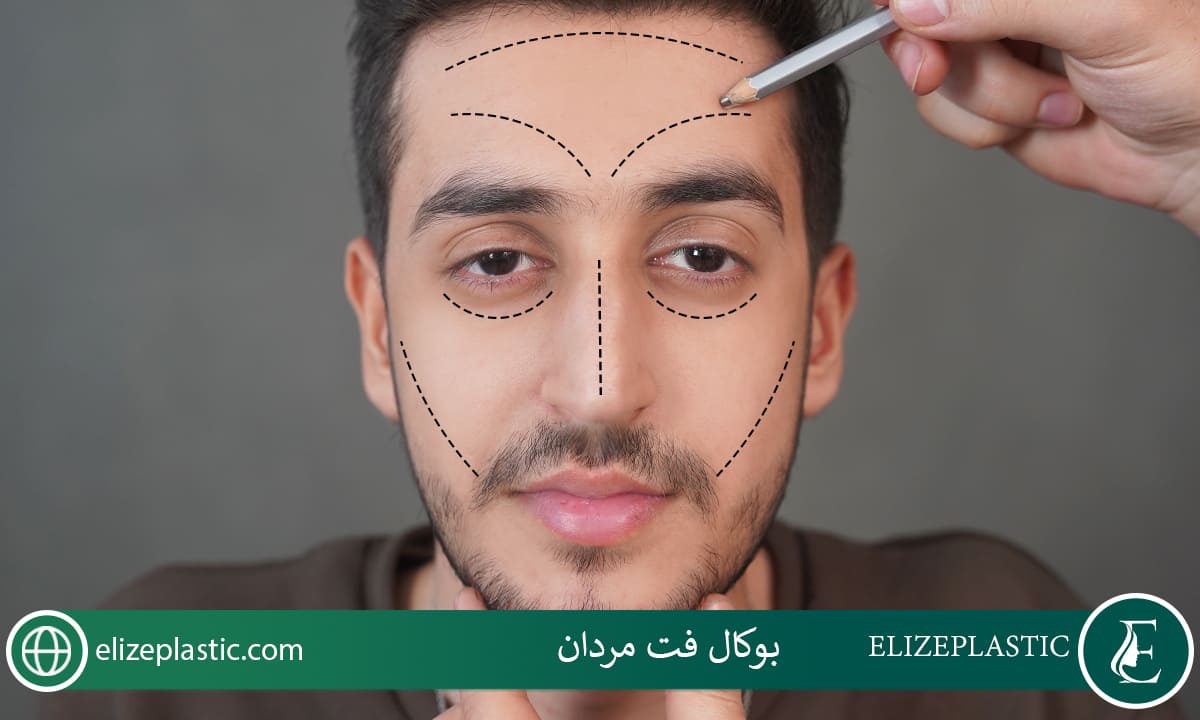 بوکال فت مردان
