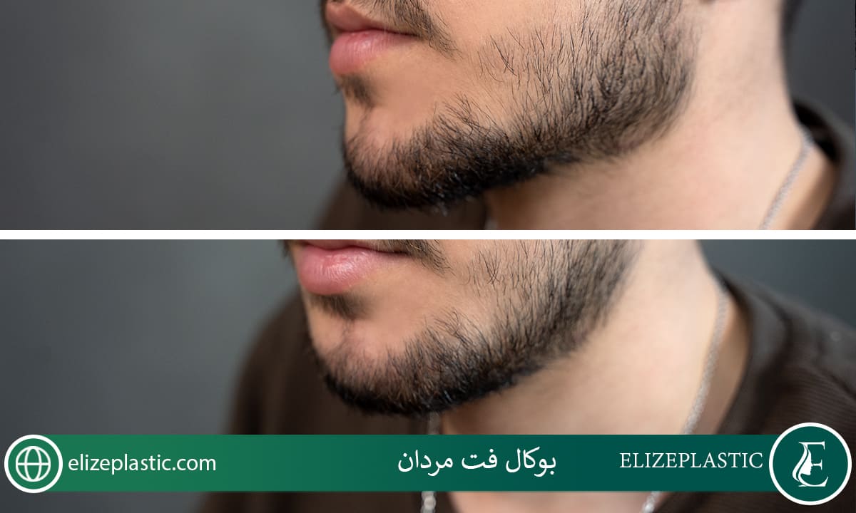 بوکال فت مردان